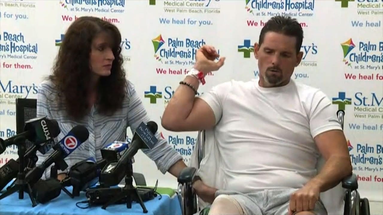 Florida Man Survives a Gator Attack Ordeal